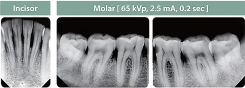 Intra-Oral X-Ray