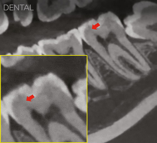 dental-vs-endo-2a
